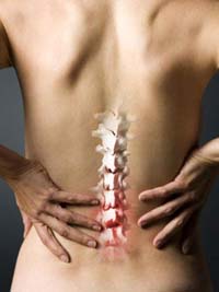 Implant và loãng xương