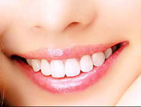 Răng chắc nướu khỏe 