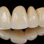 Toàn sứ ZIRCONIUM (CERCON, E.MAX ZIR CAD) - Chuẩn mực mới trong phục hình nha khoa!