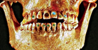 Răng cẩn đá quý 2.500 năm trước