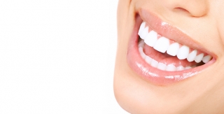 Cười hở nướu do răng khi có tình trạng hô hay răng mọc dài 