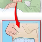 Nguy hiểm do nghiến răng