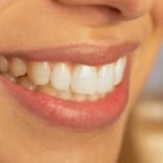 SÂU RĂNG : ÂM THẦM MÀ DỮ DỘI