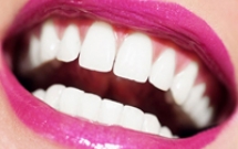 Có nhiều vấn đề mà bệnh nhân chưa biết khi đi tẩy trắng răng 