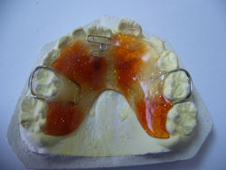 khi-cu-chinh-hinh-1