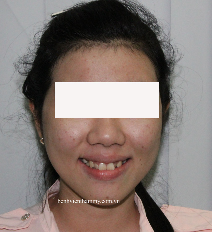 rang chen chuc 12