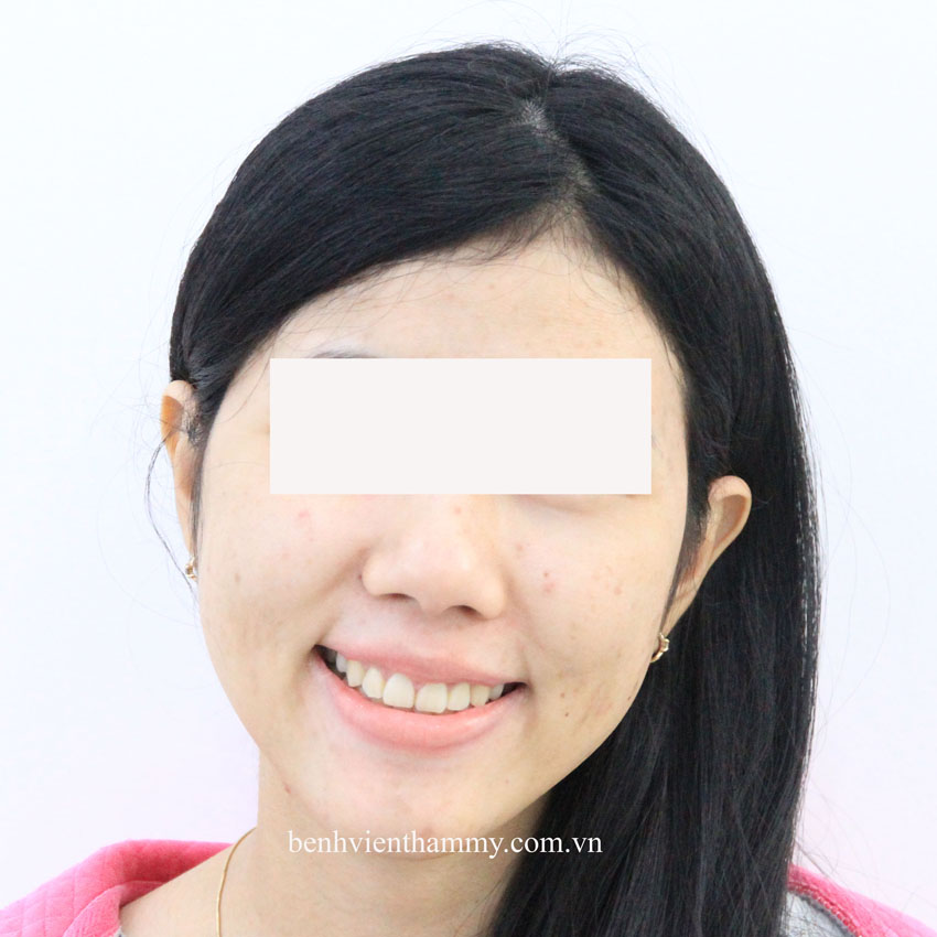 rang chen chuc 17