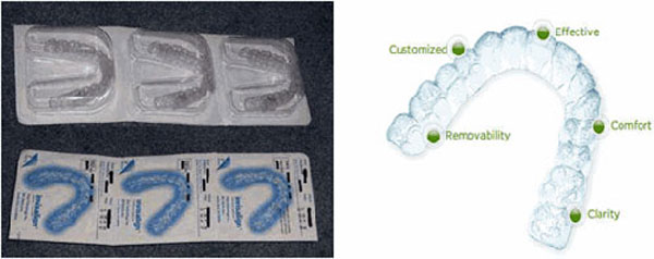 chinh-nha-invisalign-03