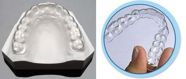 chinh-nha-invisalign-05