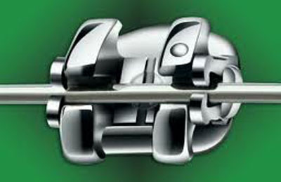 smart-clip-kim-loai