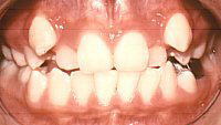 ls-chinh-hinh-003
