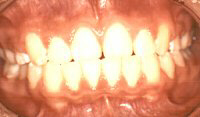 ls-chinh-hinh-004