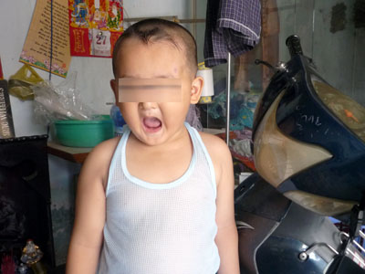 be-khong-rang-1