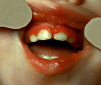 viem-nuou-22