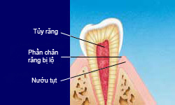 nhay-cam-rang-ava-1