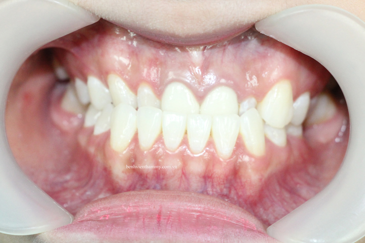 thiet ke nu cuoi dep 1 copy