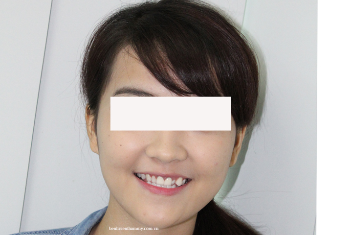 thiet ke nu cuoi dep 2